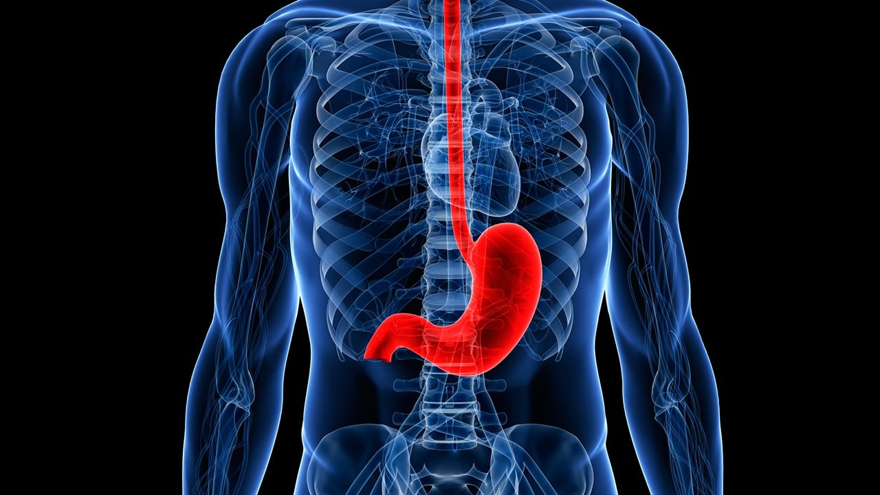 Los medicamentos antiinflamatorios como el ibuprofeno y el naproxeno disminuyen la protección gástrica y aumentan el riesgo de úlceras (Oncosalud Entidad oncológica especializada en prevención, diagnóstico y tratamiento del cáncer)