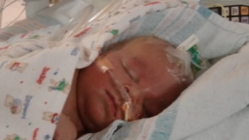 Primer plano de un infante durmiendo envuelto en una manta con dibujos, con tubos médicos visibles en su rostro, en un entorno hospitalario