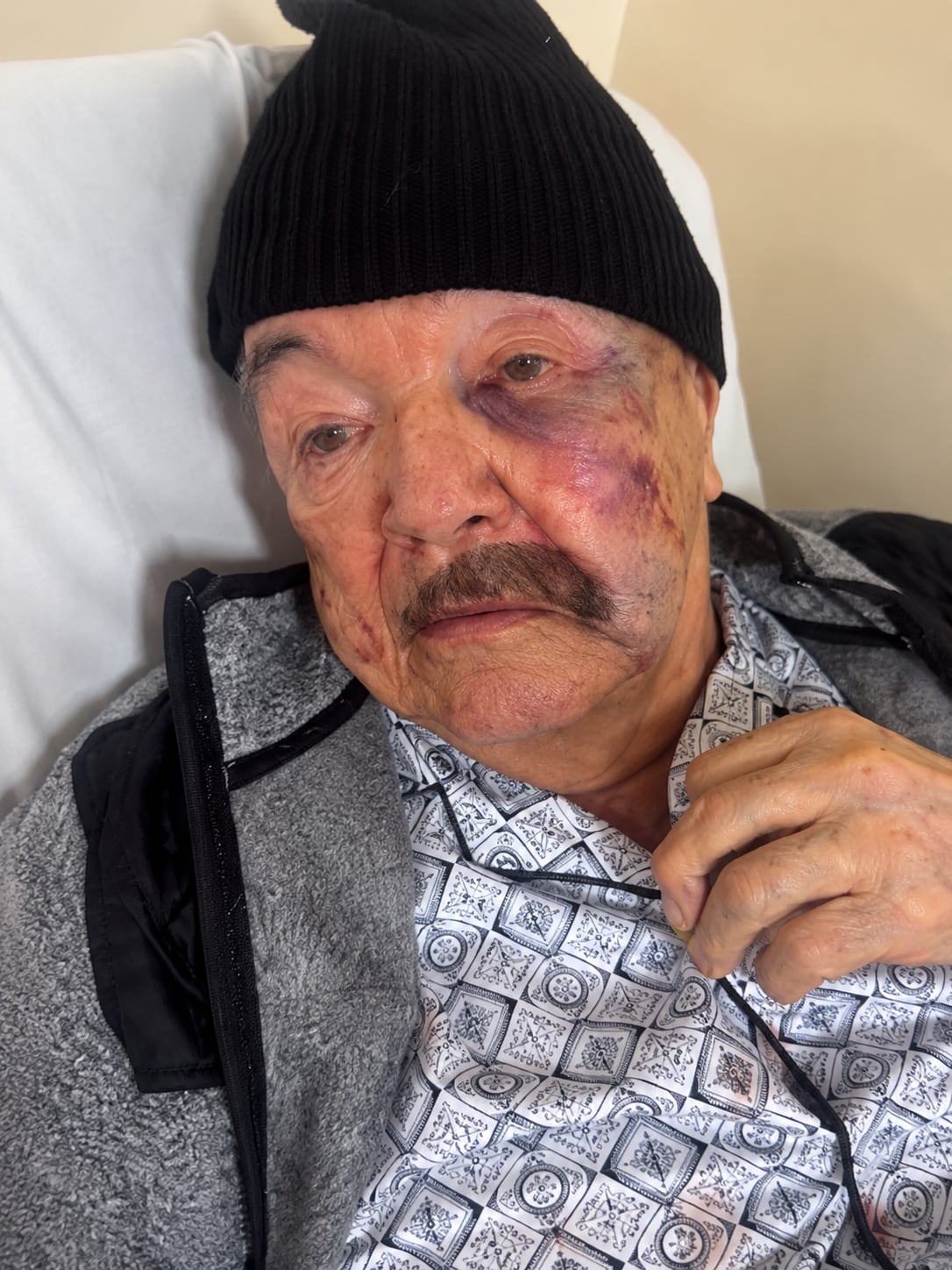 El ciudadano de la tercera edad deberá ser tratado quirúrgicamente tras la golpiza - crédito captura de pantalla angieruhu/Instagram