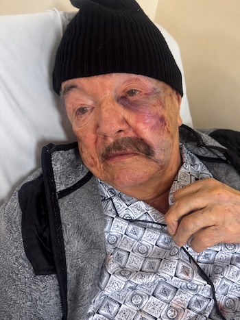 El ciudadano de la tercera edad deberá ser tratado quirúrgicamente tras la golpiza - crédito captura de pantalla angieruhu/Instagram