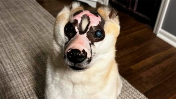 Taka resultó con quemaduras graves