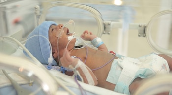 La retinopatía del prematuro es una de las principales causas prevenibles de ceguera infantil. Cuando se diagnostica en estado severo, el tratamiento debe realizarse entre 48 y 72 horas, pues cualquier demora reduce drásticamente las posibilidades de conservar la visión - crédito Visuales IA