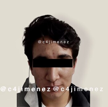 Carlos "N" sigue detenido (Foto:
