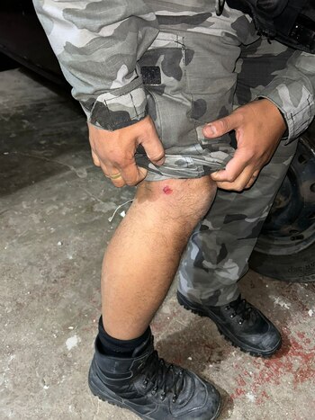 Un policía resultó herido en