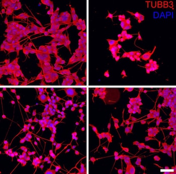 Neuronas muriendo con la toxina