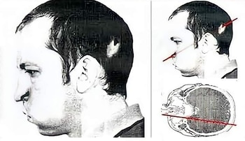 El lado izquierdo de su