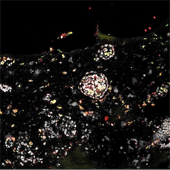 Estudios en organoides derivados de