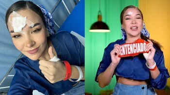 ‘El Gran Chef Famosos’: Ale Fuller sufrió fuertes quemaduras mientras abría una lata caliente de leche condensada. Latina TV. Instagram