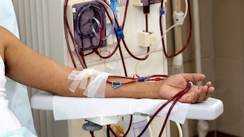 Seguro Social reporta un aumento anual de 100 pacientes con enfermedad renal crónica en El Salvador