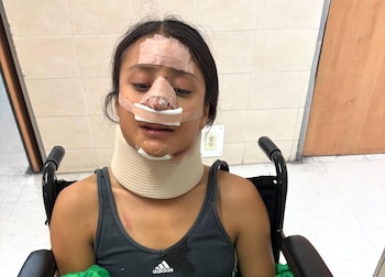La atleta sufrió una fractura de nariz en uno de los entrenamientos debido a que una camioneta obstruyó su carril y la arrolló. (Instagram: Yuli Flores)