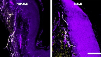 La investigación identificó diferencias en