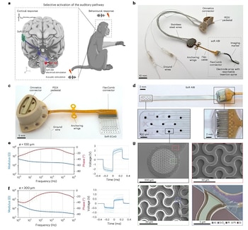 El nuevo implante auditivo fue