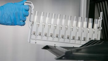 Identifican 17 nuevas variantes genéticas