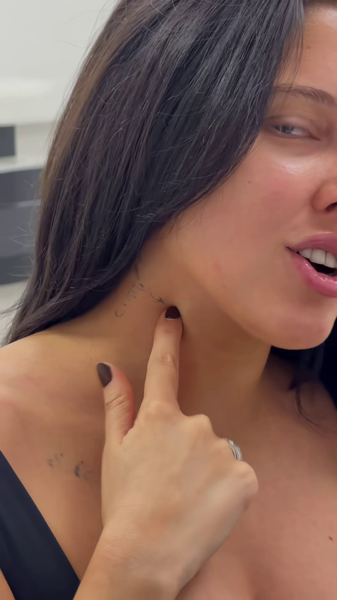 La Reini señala una marca en su cuello mientras realiza un tratamiento para la eliminación de sus tatuajes.