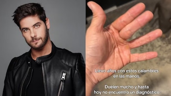 Andrés Wiese preocupa a sus seguidores tras pedir ayuda por misteriosa enfermedad que afecta sus manos: “Duelen mucho”