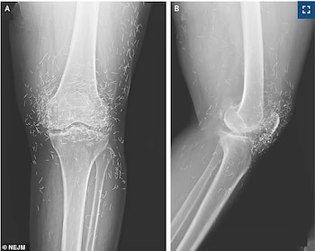 Una radiografía en Corea del