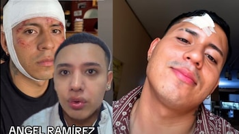 Tiktoker Ángel Ramírez termina con un corte en la frente luego de ser agredido en una discoteca en Trujillo