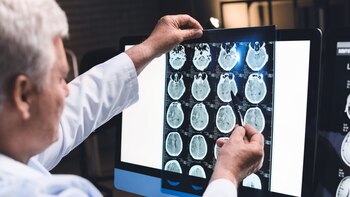 Por qué las lesiones cerebrales