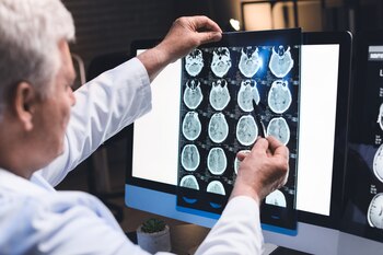 Las lesiones cerebrales traumáticas, un