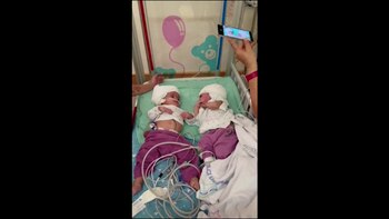 La imagen de las siamesas