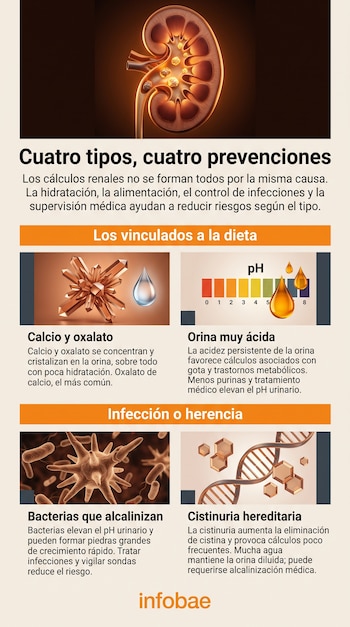 Infografía sobre cálculos renales con la ilustración de un riñón y cuatro secciones con imágenes de cristales, escala de pH, bacterias y ADN.