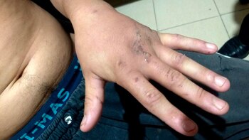 Así tenía las manos el