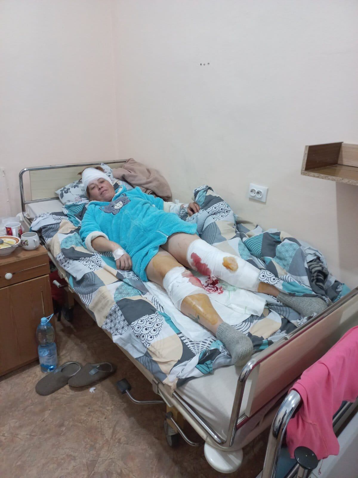 Natalia Dergach en el hospital tras ser alcanzada por explosivos lanzados desde un dron. (archivo personal de Natalia Dergach)