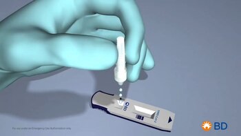 El método de examen es