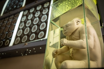 Museo del Cerebro