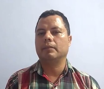 La hemofilia tipo A severa