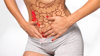 La colitis es una enfermedad