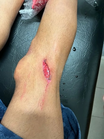 La foto que se viralizó