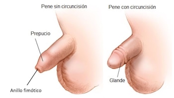 Al momento de una erección