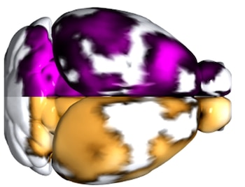 Reconstrucción 3D de los hemisferios cerebrales del modelo de ratón de alzhéimer con regiones en las que existe una mayor captación de fibrina (violeta) y de plaquetas (dorado).