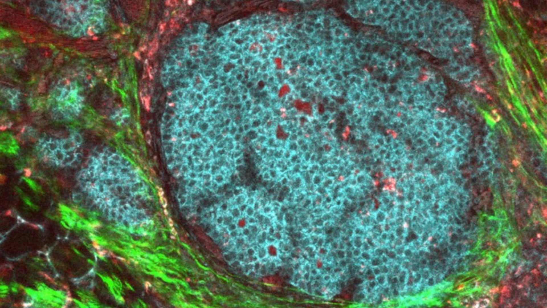 El ejercicio no mostró una asociación clara con una mayor supervivencia libre de progresión ni con una mejor respuesta patológica completa tras los tratamientos estándar. (National Cancer Institute)