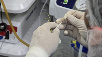 Colocan prótesis biodegradable y logran recuperar la salud de paciente con obstrucción biliar