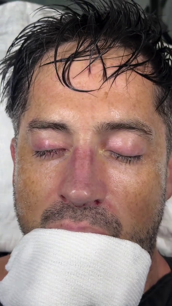 Devi luego de salir del quirófano