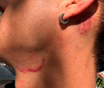 La salvaje agresión ocurrió durante