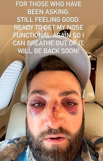 Kevin Pillar mostró en su