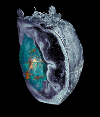 Acumulación de nanorobots en el tumor visualizada mediante microscopía (IRB Barcelona)
