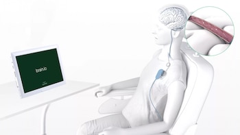 La empresa neoyorquina Synchron ha