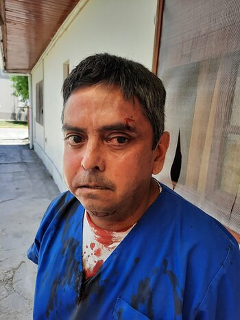 Marcelo Cachagua denunció a Diego