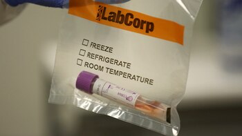 EEUU autorizó los test grupales