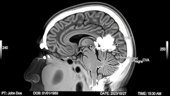Robótica a distancia e inteligencia