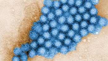 Qué es el norovirus identificado