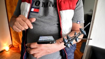 Reconstrucción de manos en Bogotá