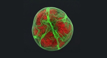 Imagen LGEZTR7QBZHSNIPEKCEJWVC4SE