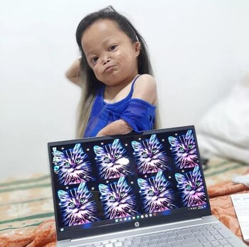 Diana Moreno padece de acondroplasia,