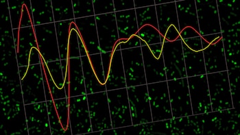 Imagen obtenida por microscopía de