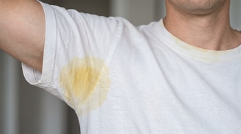 Torso de una persona con una camiseta blanca que tiene una mancha amarilla debajo de la axila y alrededor del cuello.
